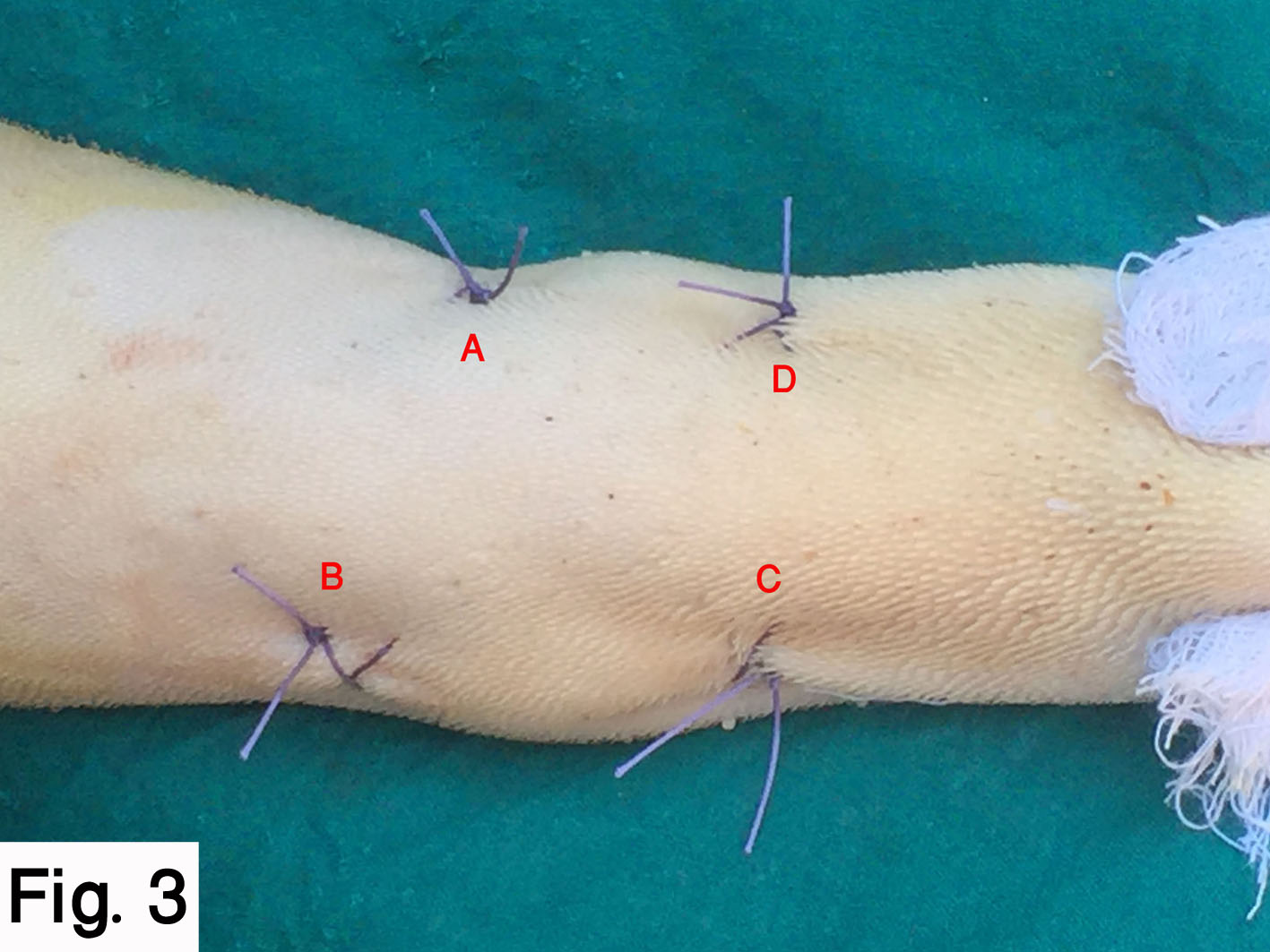 Intra-lingual suture pattern for prevention of self-suckling in cows